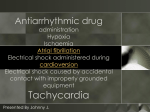 Supraventricular Tachycardia