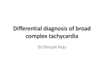 Differential diagnosis of broad complex tachycardia