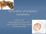 Perforation of tympanic membrane