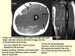 Popliteal Lab - Yale Radiology