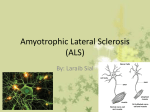 Amyotrophic Lateral Sclerosis