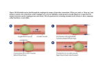 Figure 10.8 Peristalsis moves food through the esophagus by