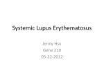 Systemic Lupus Erythematosus