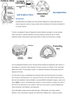 Herniated Disc and Sciatica Facts