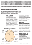 Bicoronal craniosynostosis - Great Ormond Street Hospital