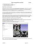 Globus tracing guidelines using Slicer K