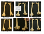 greater trochanter head intercondylar notch lateral condyle lateral