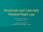 Shortened and Internally Rotated Right Leg