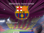 Metastatic Disease