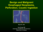 Esophageal - UCSF School of Medicine