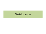 Gastric cancer