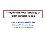 Arryhythmias post-TOF repair surgical repair