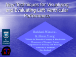 The Visualization of Two-Dimensional Second