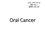 Oral cancer