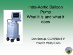 Intra-Aortic Balloon Pump What it is and what it does