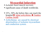 Myocardial infarction