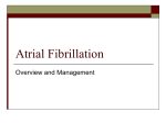 Atrial Fibrillation