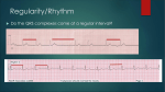 The basic`s of a 12 lead ECG part 3