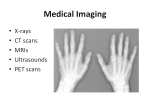 X-Ray imaging Used in many different ways in medical diagnosis. A