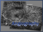 Angiography - WordPress.com