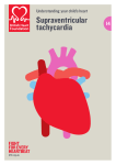 Supraventricular tachycardia