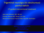 TRIGEMINAL NEURLAGIA