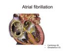 Atrial fibrillation