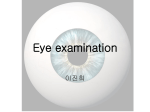 Eye examination