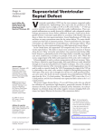 Supracristal Ventricular Septal Defect