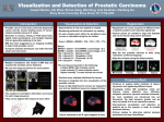 Visualization and Detection of Prostatic Carcinoma