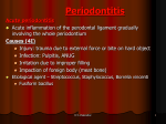 Periodontitis