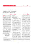 Supraventricular tachycardia - Houston Electrophysiology Associates