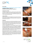 Surgical Repair of the Peroneus Brevis Tendon