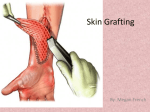 Skin Grafting