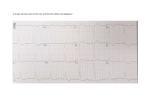 ECG Quiz 24