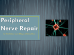 Peripheral Nerve Repair