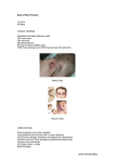 Base of Skull Fracture