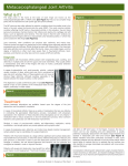 Metacarpophalangeal Joint Arthritis