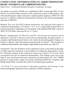 conduction abnormalities in arrhythmogenic right