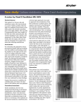 Case study: Lisfranc stabilization - Fixos 2 and Anchorage