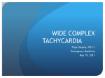 wide complex tachycardia - Calgary Emergency Medicine