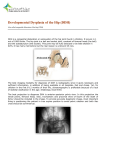 Developmental Dysplasia of the Hip (DDH)