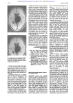 Neuromyelitis optica originally described as a distinct