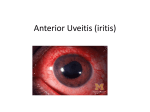 Acute uveitis - WordPress.com