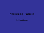 Necrotizing Fasciitis