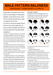 male pattern baldness - Royal Jelly Formulation from Irene Stein