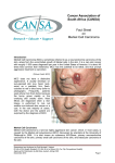 Merkel Cell Carcinoma