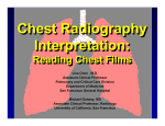 Reading Chest Films