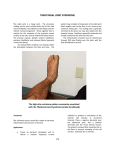 tibiotarsal joint syndrome