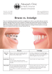 Blackrock, Co Dublin Braces vs. Invisalign